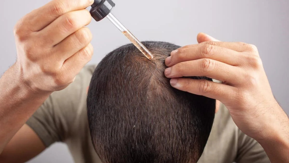 Hair Growth beyond Minoxidil